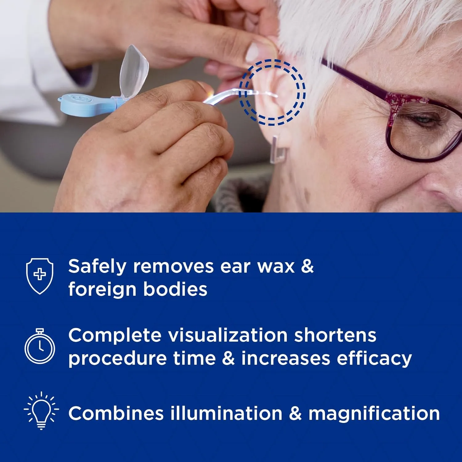 Bionix - ClearLook Lighted MicroLoop Ear Curette, Convenient & Easy-to-Use, Single-Use (50 Count)